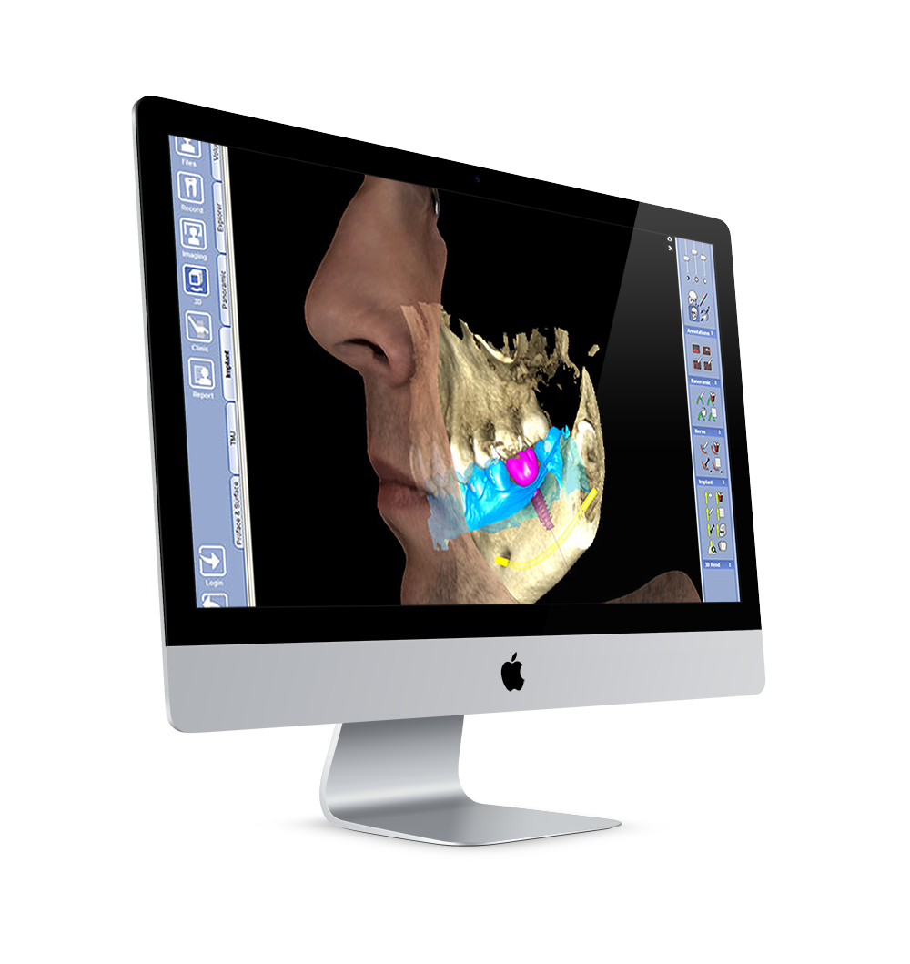 Tomografia 3D Cone beam 3D